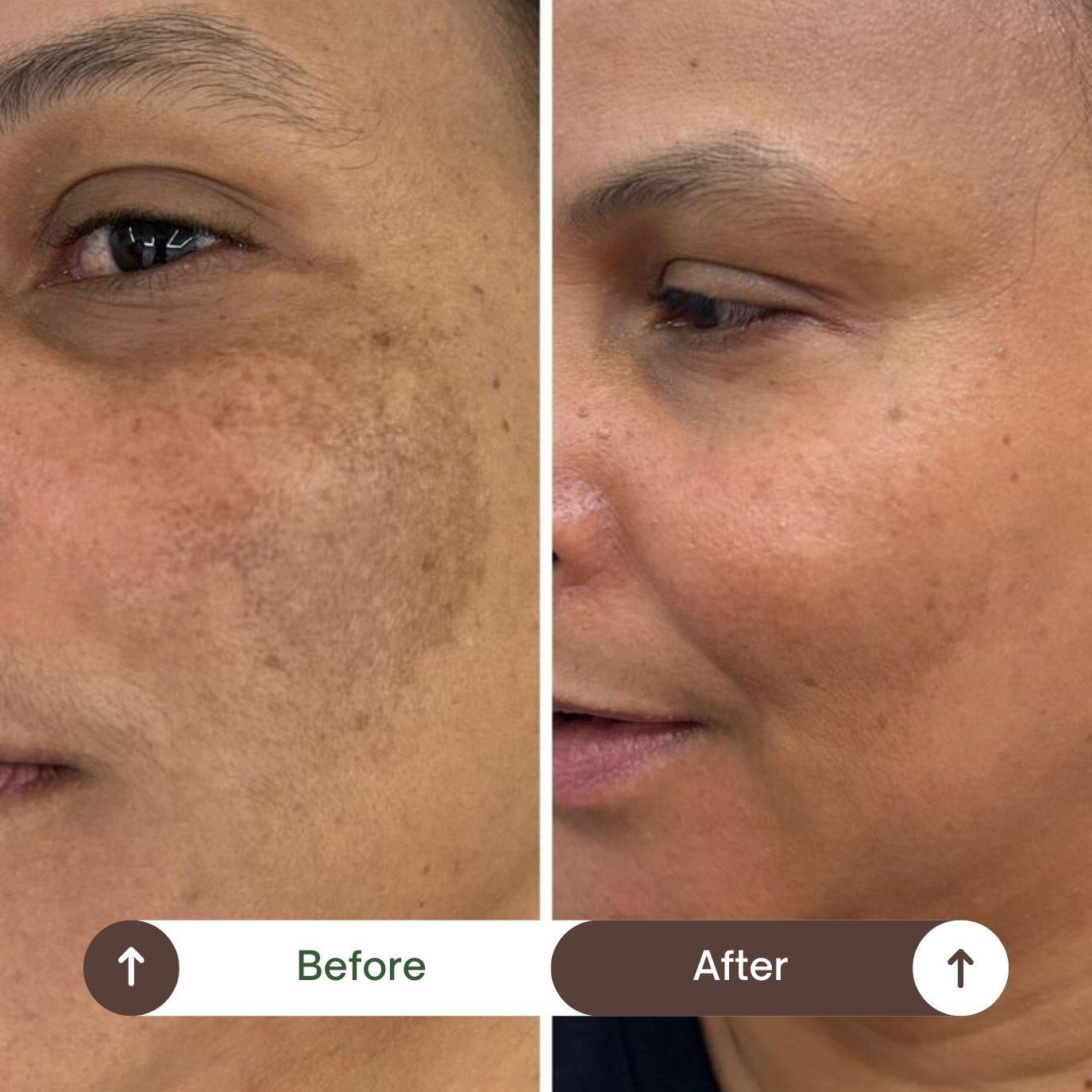 Before and after results using Skin Luxe Natural
