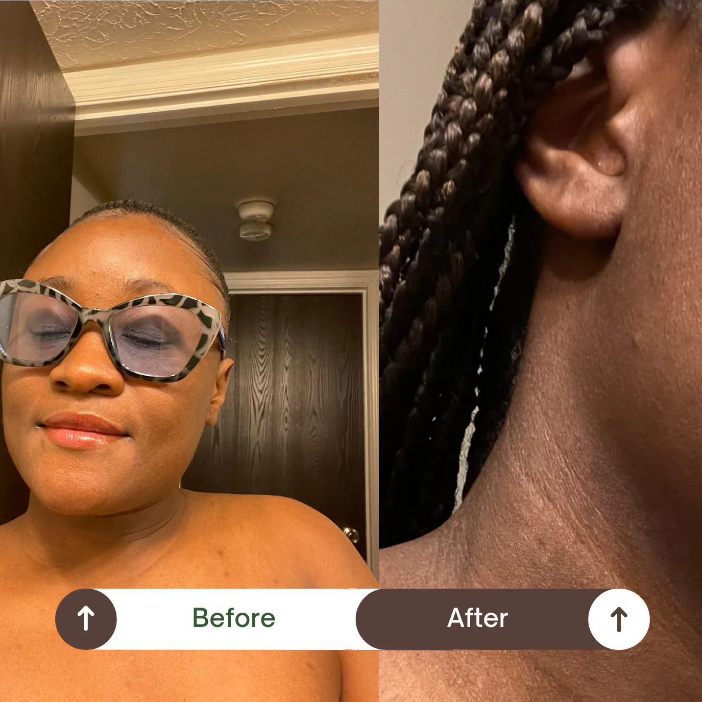 Before and after comparison of a person with hair on their head.